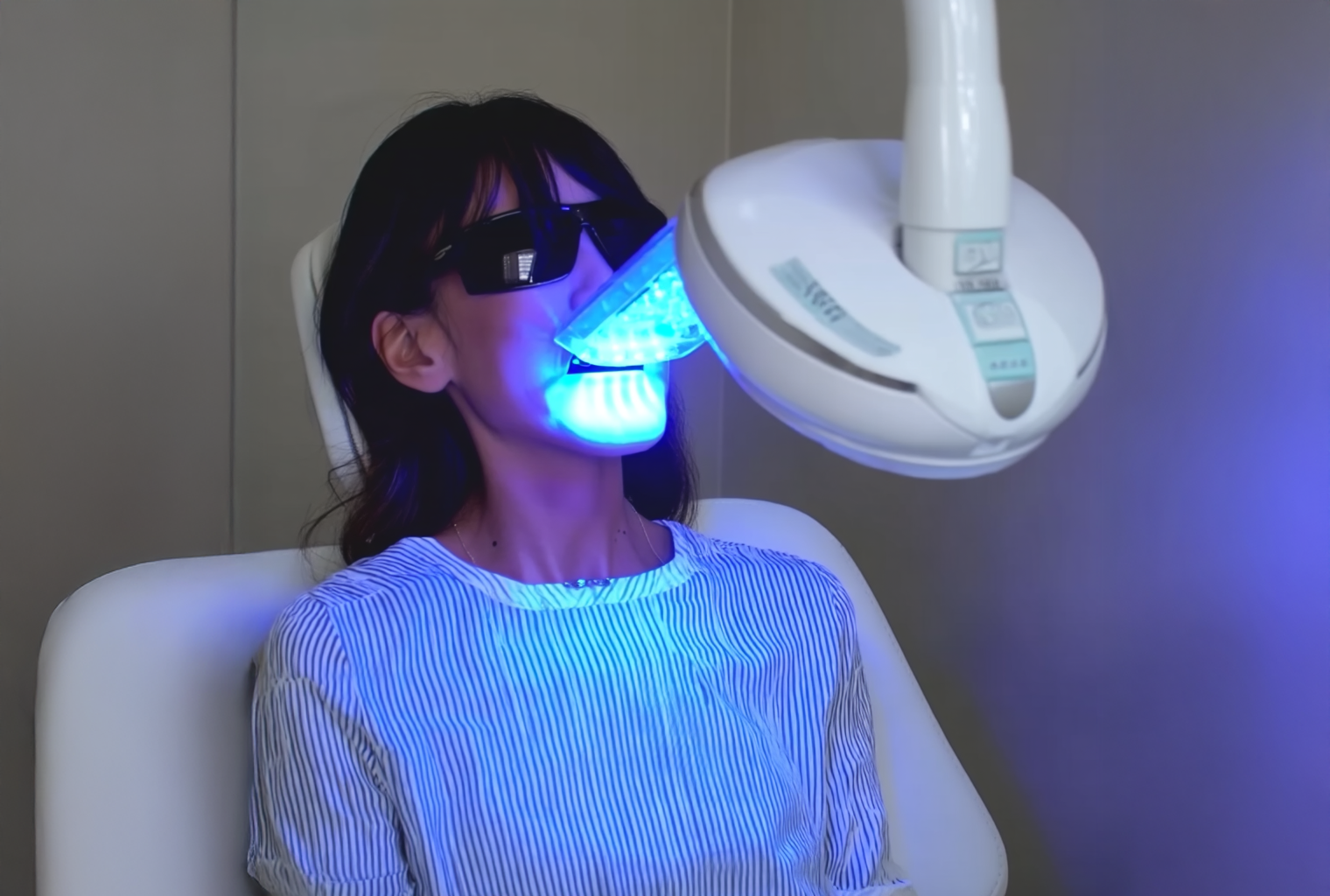 04 セルフホワイトニング施術